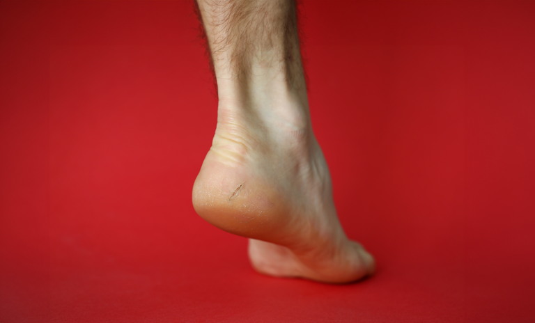 Comment soigner un cor au pied de manière efficace ?